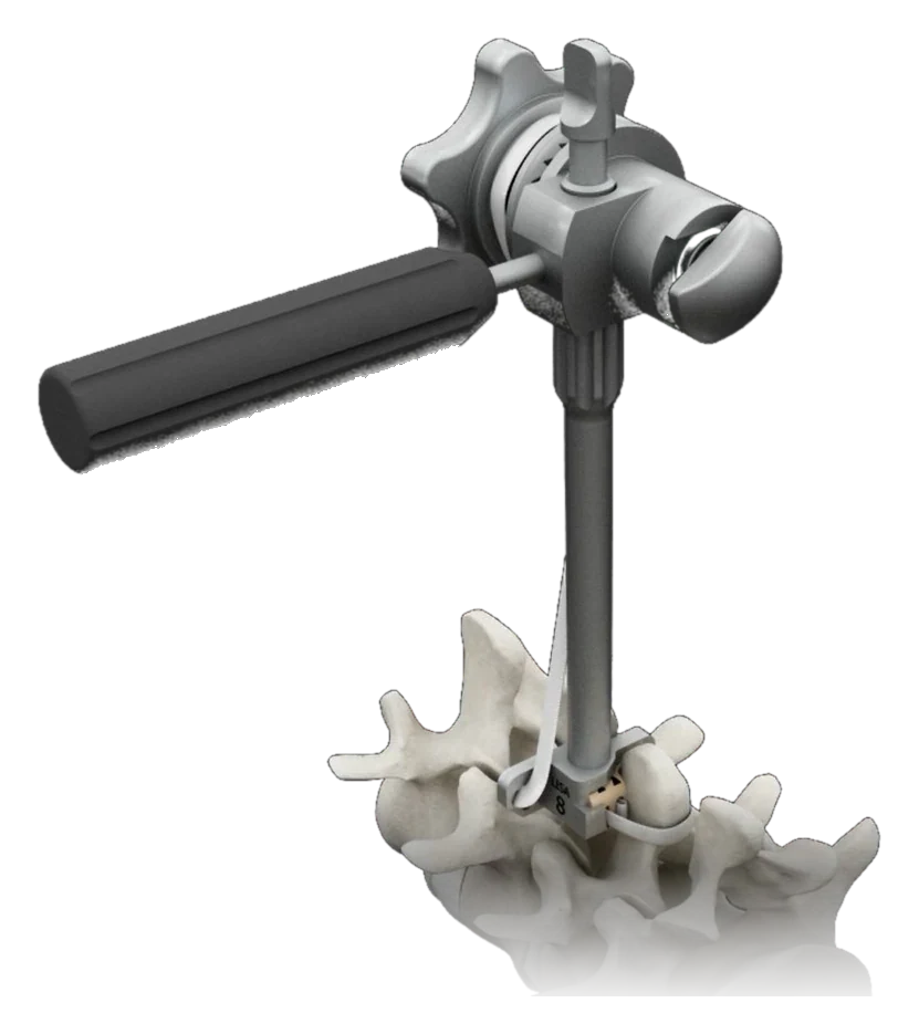 LISA tensioner on a spine model